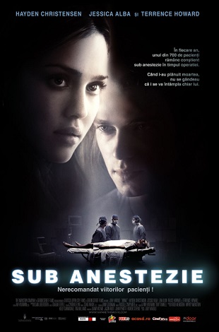 Awake - Sub anestezie vezi online