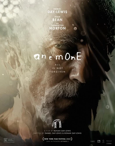 Anemone